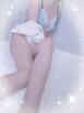 える